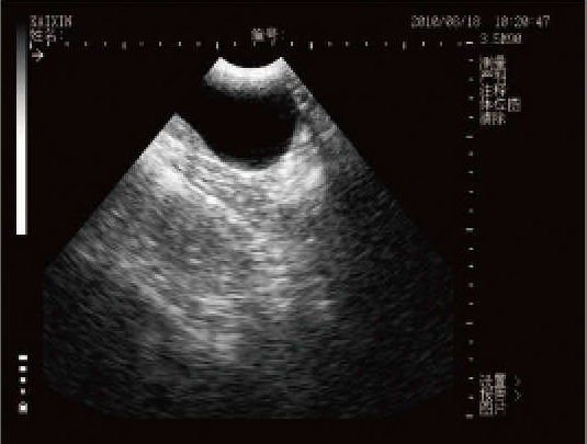 MSU2超音波圖像_狗膀胱